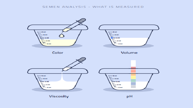 Phân tích tinh dịch (Semen Analysis) bao gồm Color: Màu sắc, Volume: Thể tích, Viscosity: Độ nhớt